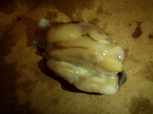 Corte de Nódulo Linfático foto: Rosa Maria Cordero Pulido