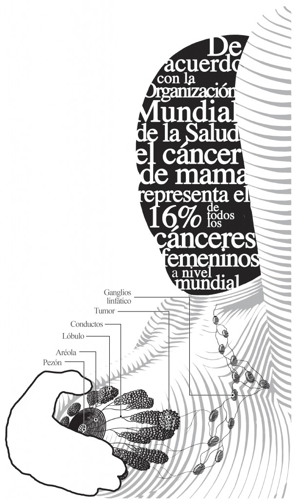 cáncer de mama-02 (1)