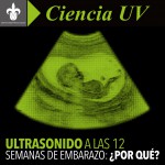 Imagen ULTRASONIDO DE LAS 12 SEMANAS DE EMBARAZO: ¿POR QUÉ?