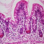 las celulas caliciformes, son consideradas glandulas unicelulares,productoras mucosustancias acidas y neutras en diversas partes del cuerpo
