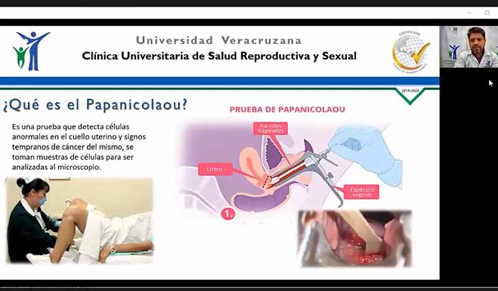 La prueba de Papanicolaou es importante para el diagnóstico oportuno del cáncer cervicouterino 