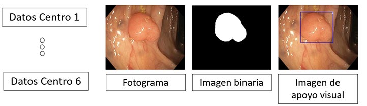 Los modelos de IA son entrenados para la detección con imágenes de casos reales para su comparación